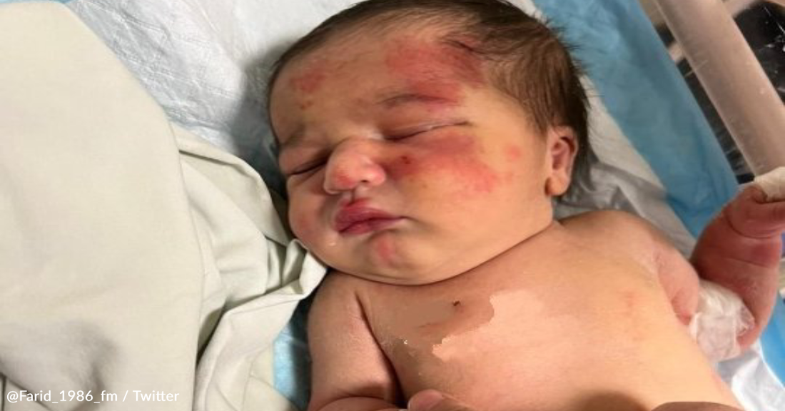A newborn baby with reddish skin and dark hair lies sleeping on a light blue hospital blanket.