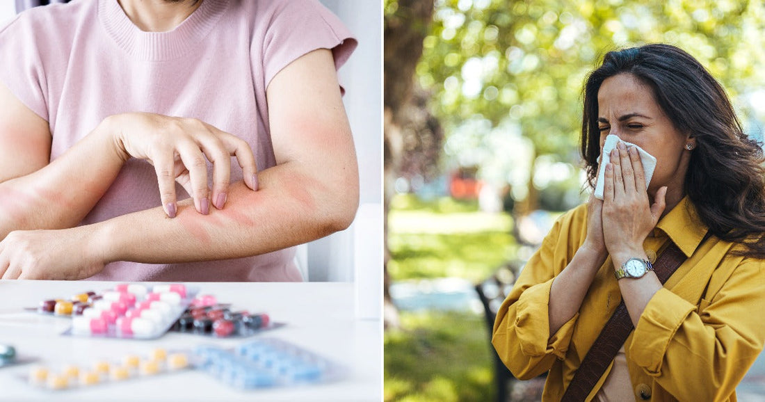 On the left, a woman scratches a red rash on her arm near pill packets; on the right, a woman blows her nose outdoors in a sunny park.