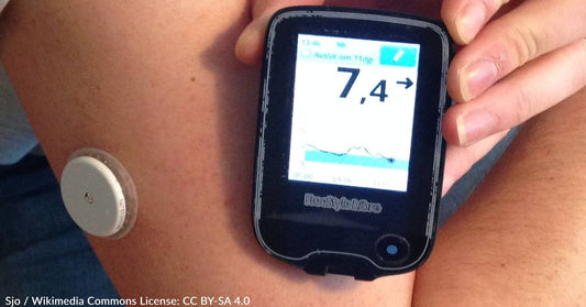 Here's Why Non-Diabetics Are Wearing Continuous Glucose Monitors