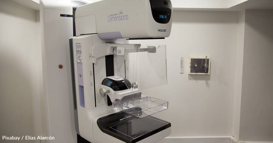 New Research Shows Potential Shortcomings in the Use of AI to Read Mammograms