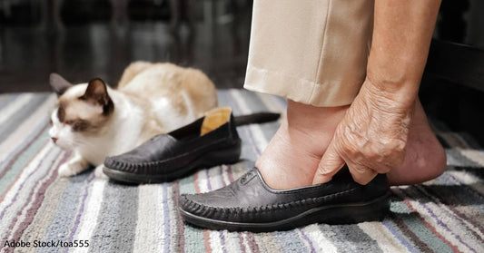 Custom Indoor Footwear Improves Compliance and Outcomes for People at Risk of Foot Ulcers