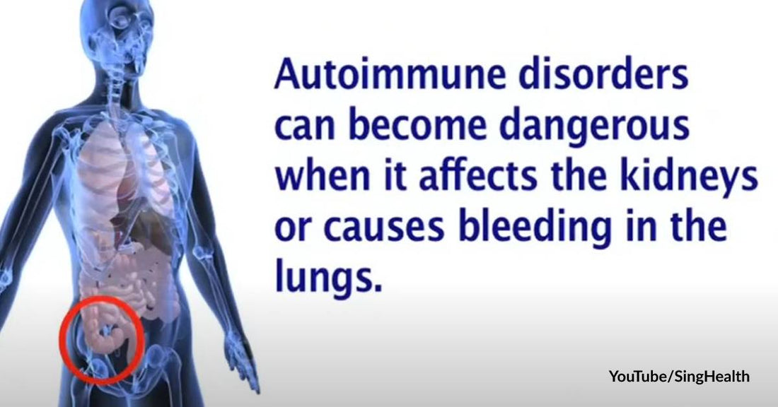 Autoimmune Diseases Are More Prevalent Than Ever! Here's What You Should Know about Them