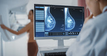 doctor examining mammogram images of woman's breast