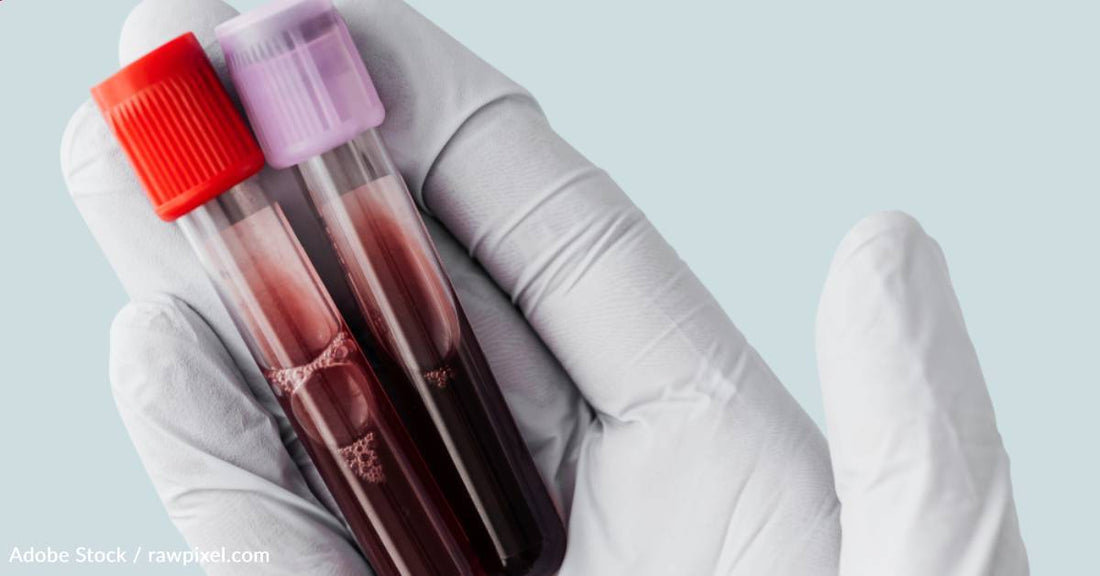 In New Study, Blood Test Detects Alzheimer's Proteins Years Before Symptom Onset