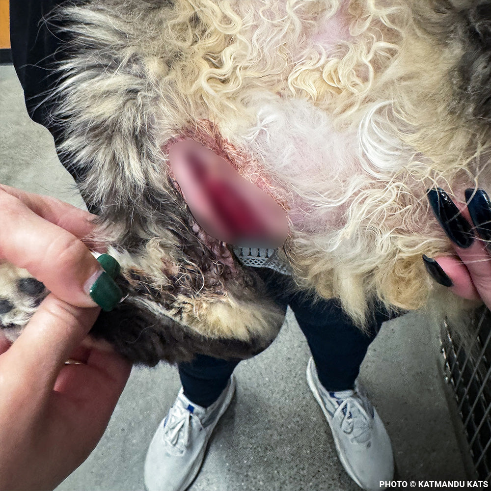 Fatima's Severe Leg Wound Needs Urgent Care