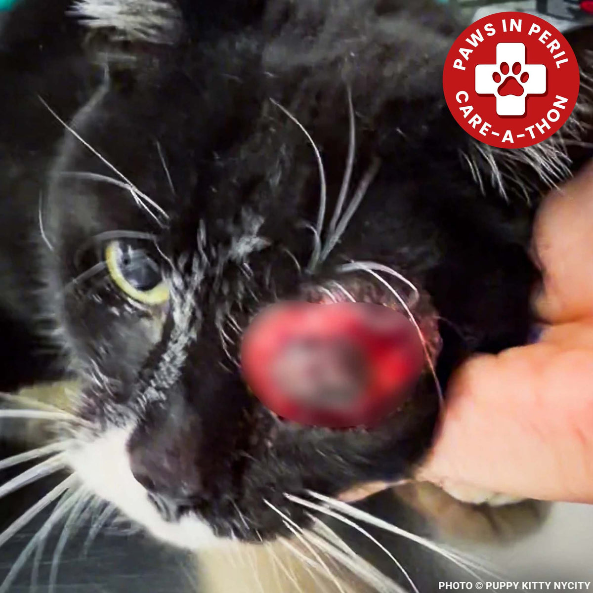 Funded: Neo with Painful Protruding Eye Needs Emergency Surgery